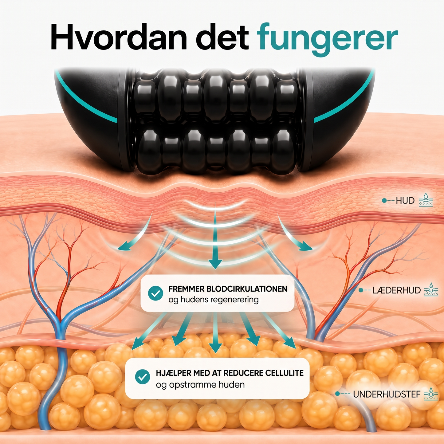 RollerMotion® – Kropsformningssystem